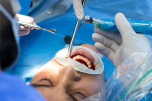 Chirurgie Dentară